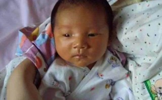 胎黄，胎黄是什么意思